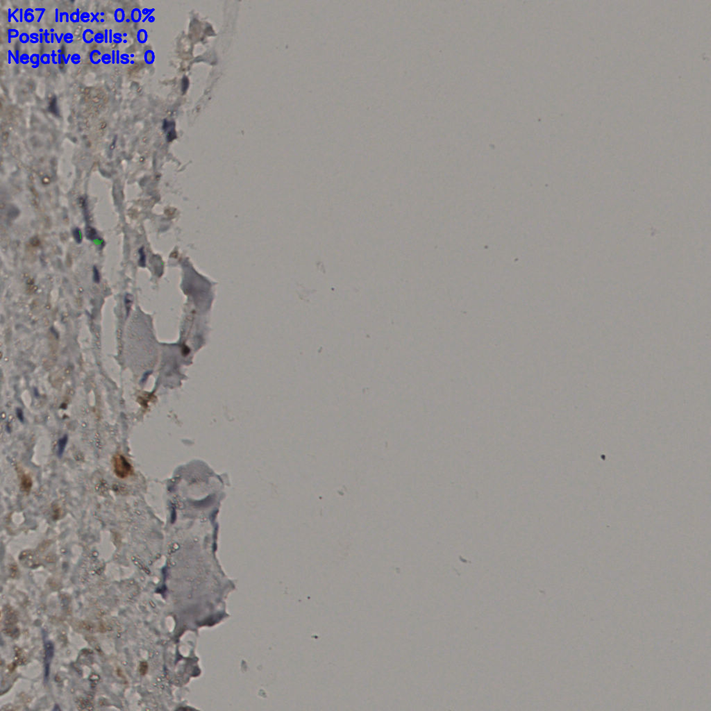 slice_32_31_x28672_y27776.png
