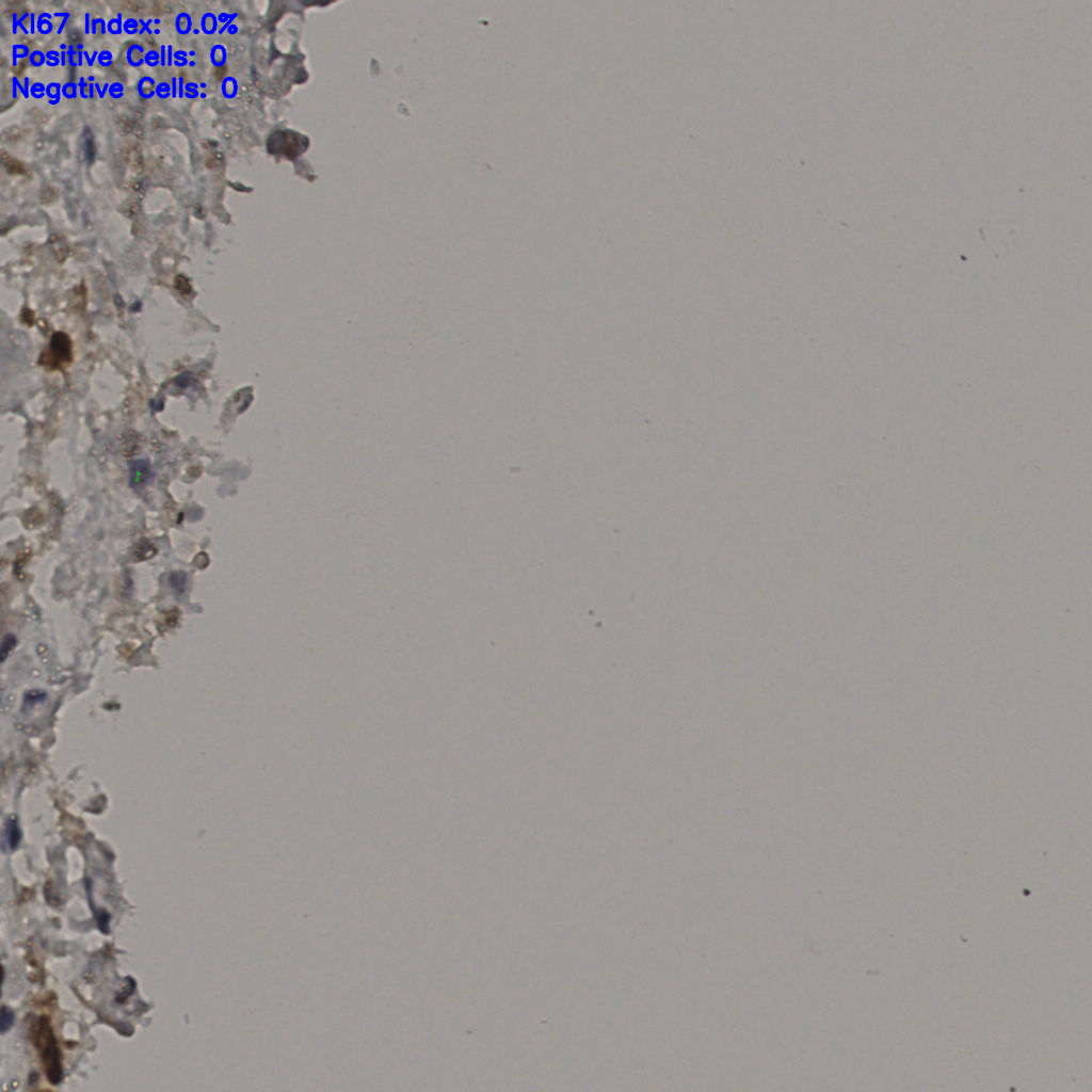 slice_32_32_x28672_y28672.png