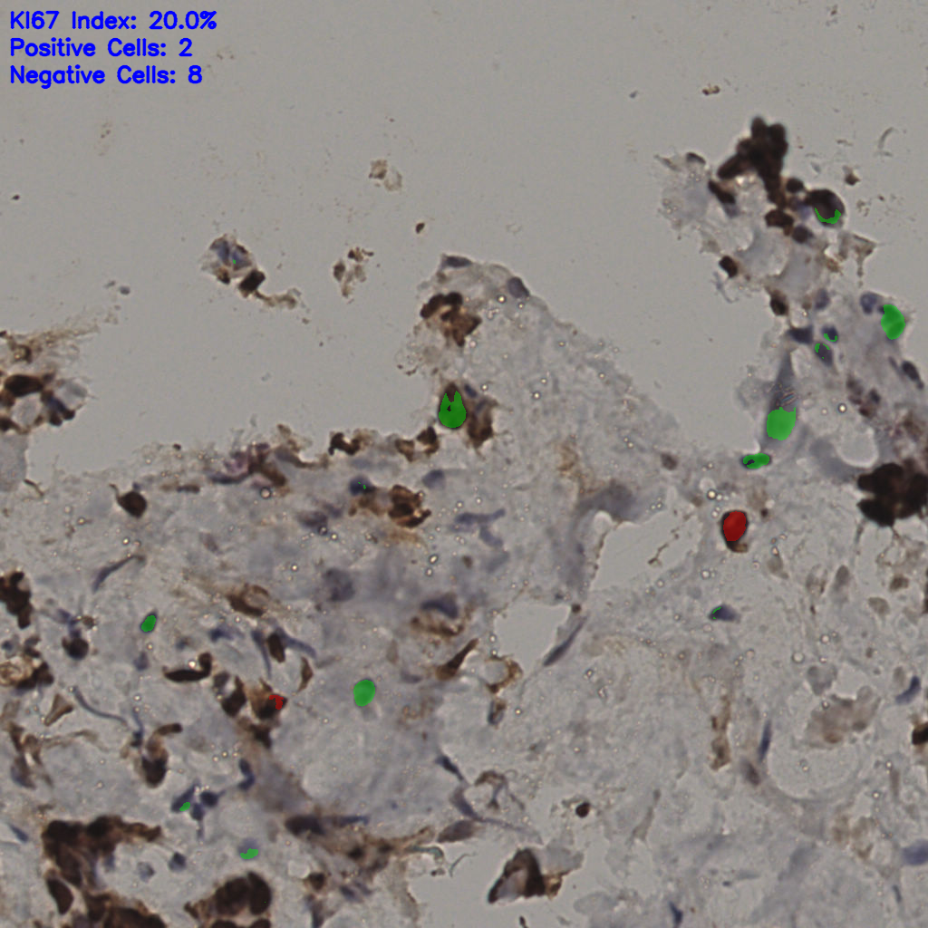 slice_33_13_x29568_y11648.png