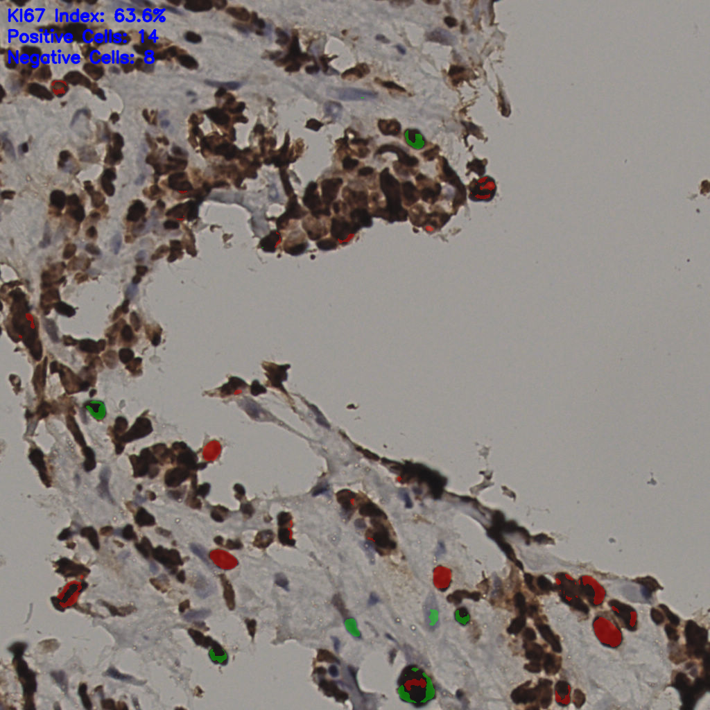 slice_33_15_x29568_y13440.png