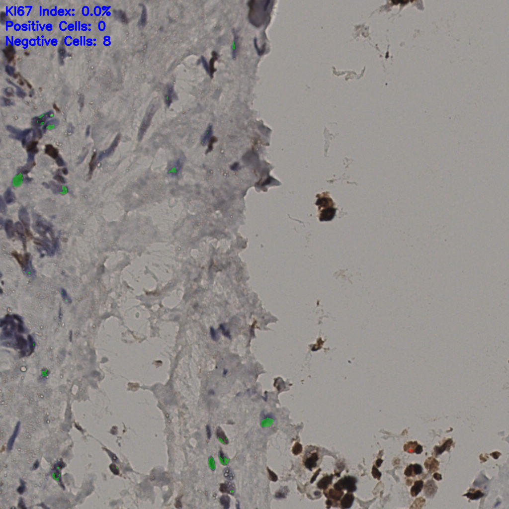 slice_33_17_x29568_y15232.png