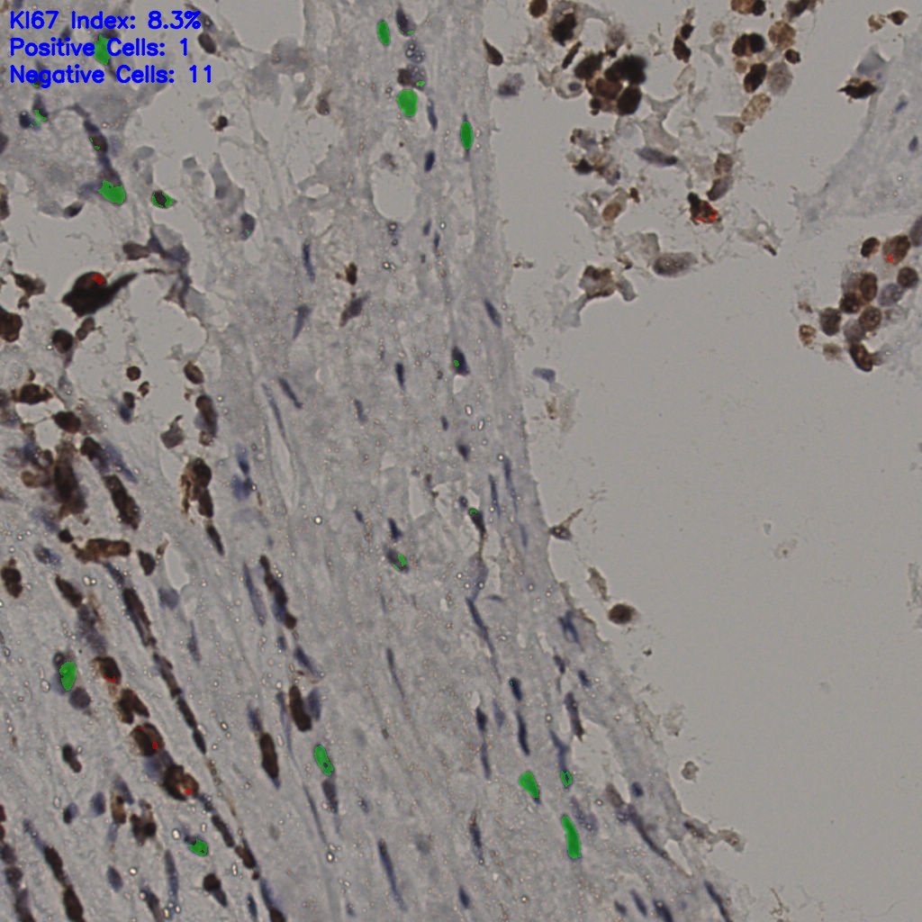 slice_33_18_x29568_y16128.png