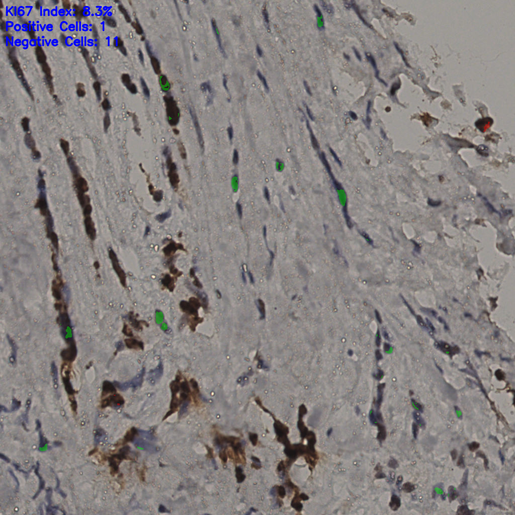 slice_33_19_x29568_y17024.png