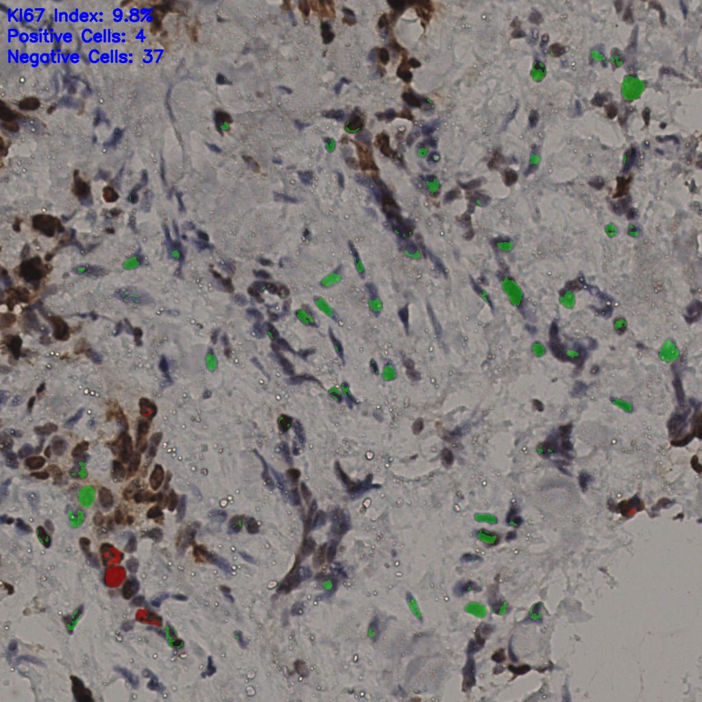 slice_33_20_x29568_y17920.png