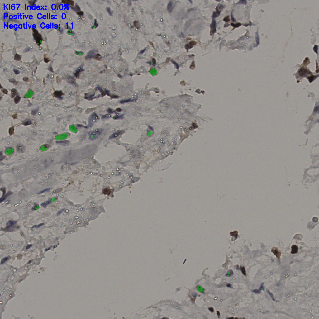 slice_33_21_x29568_y18816.png