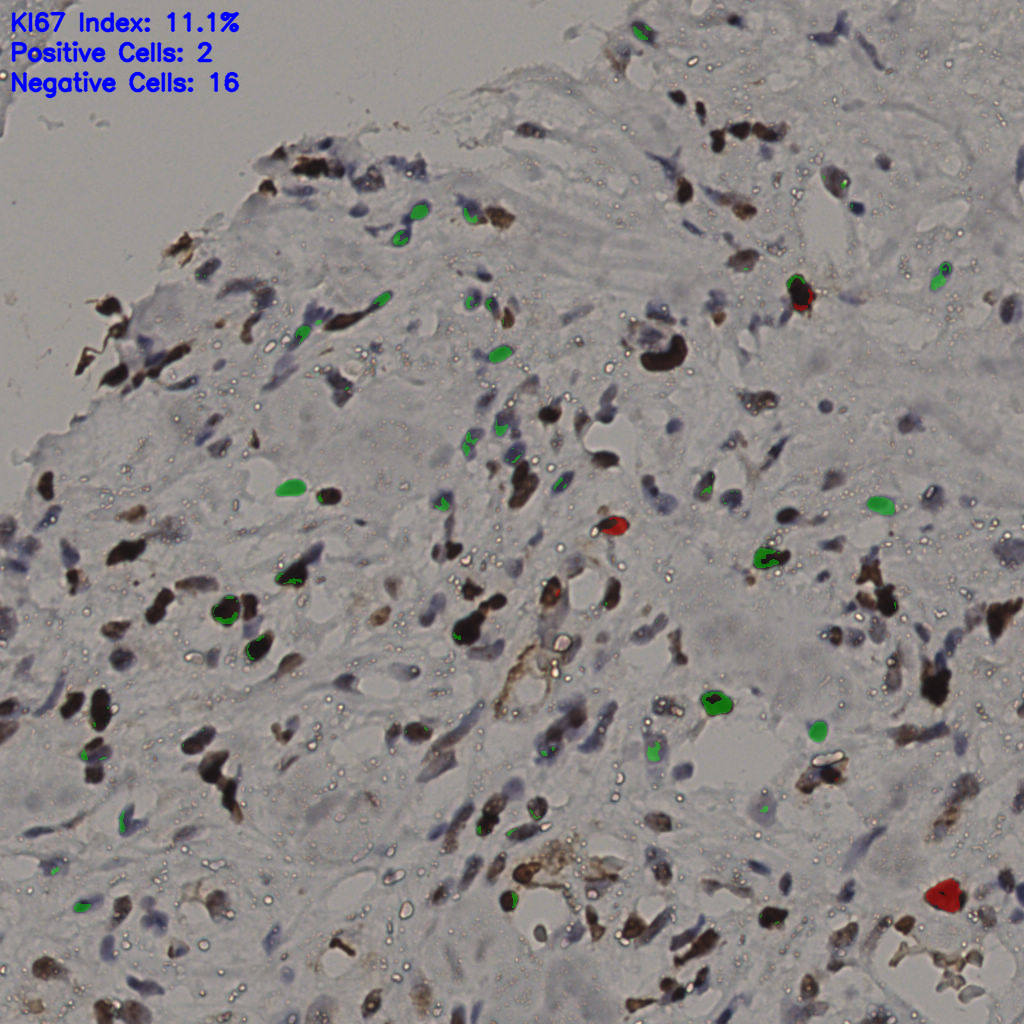 slice_33_22_x29568_y19712.png