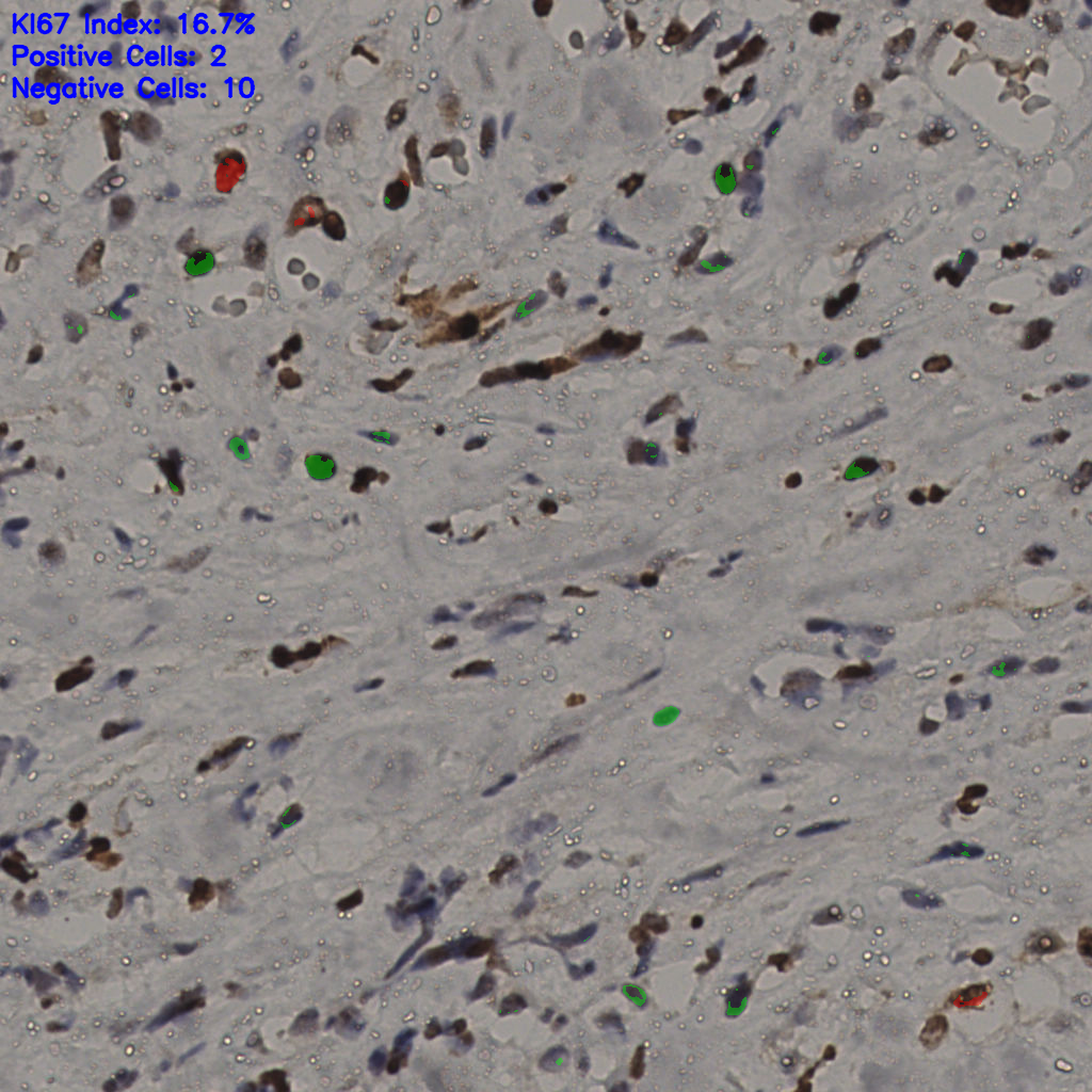 slice_33_23_x29568_y20608.png