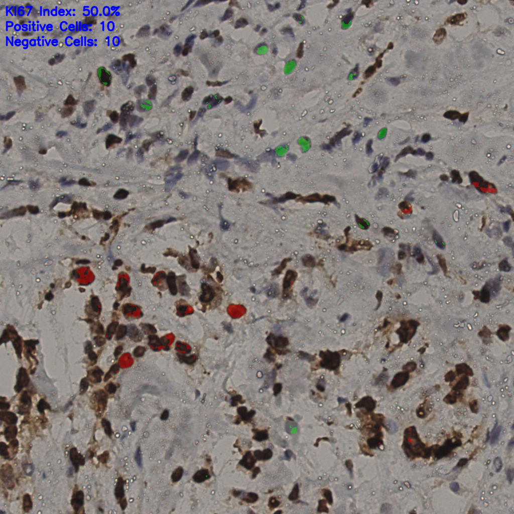 slice_33_24_x29568_y21504.png