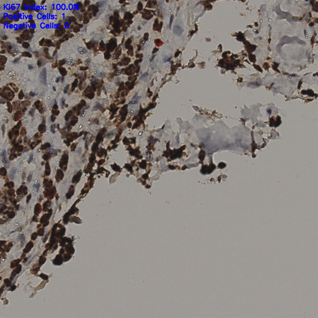 slice_33_27_x29568_y24192.png
