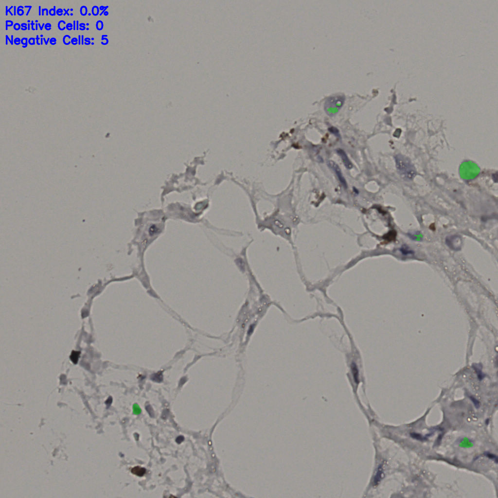 slice_33_7_x29568_y6272.png