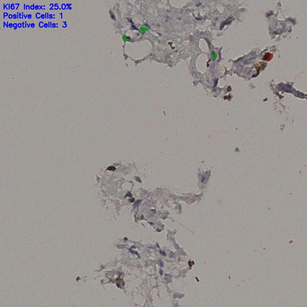 slice_33_9_x29568_y8064.png