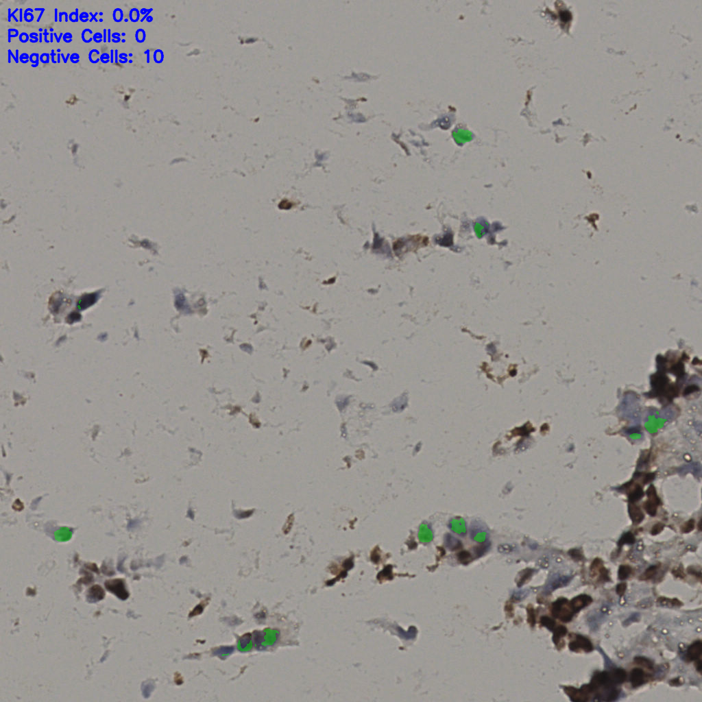 slice_34_12_x30464_y10752.png