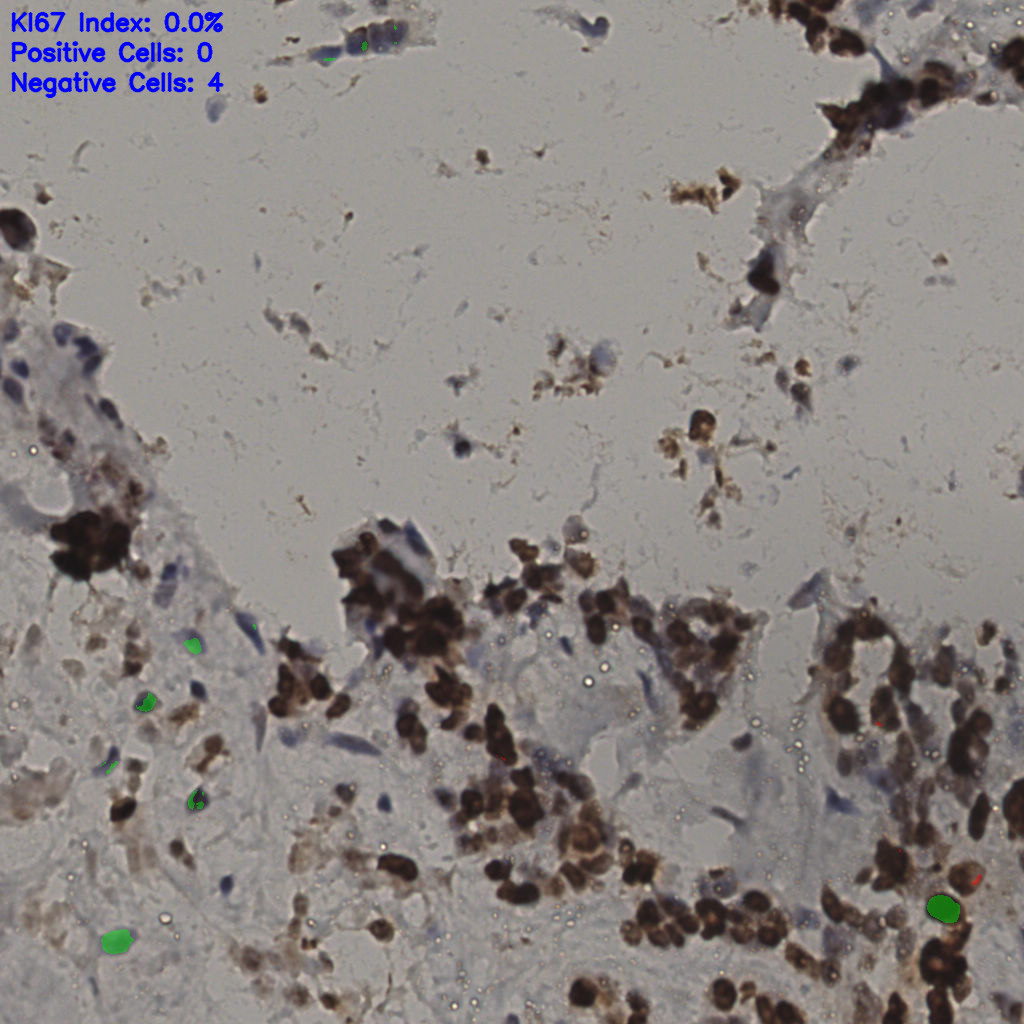 slice_34_13_x30464_y11648.png