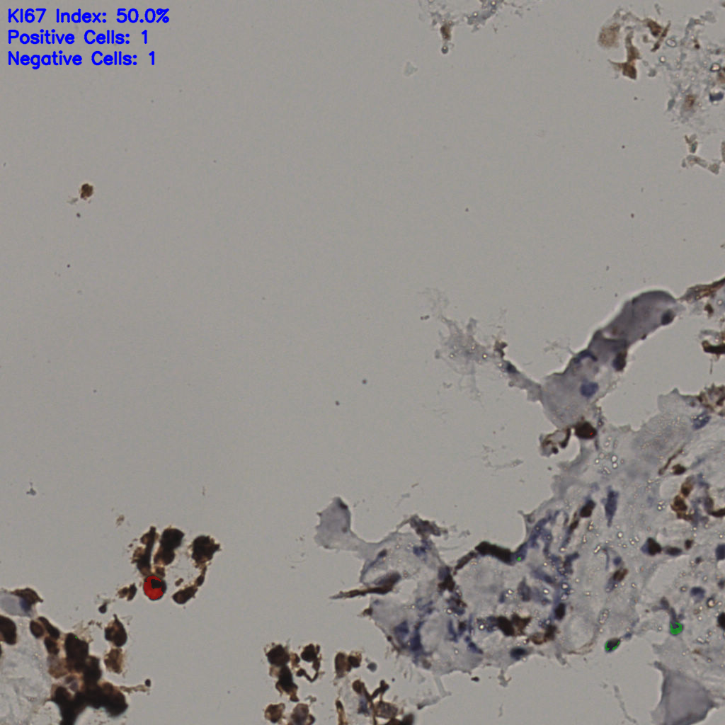 slice_34_15_x30464_y13440.png