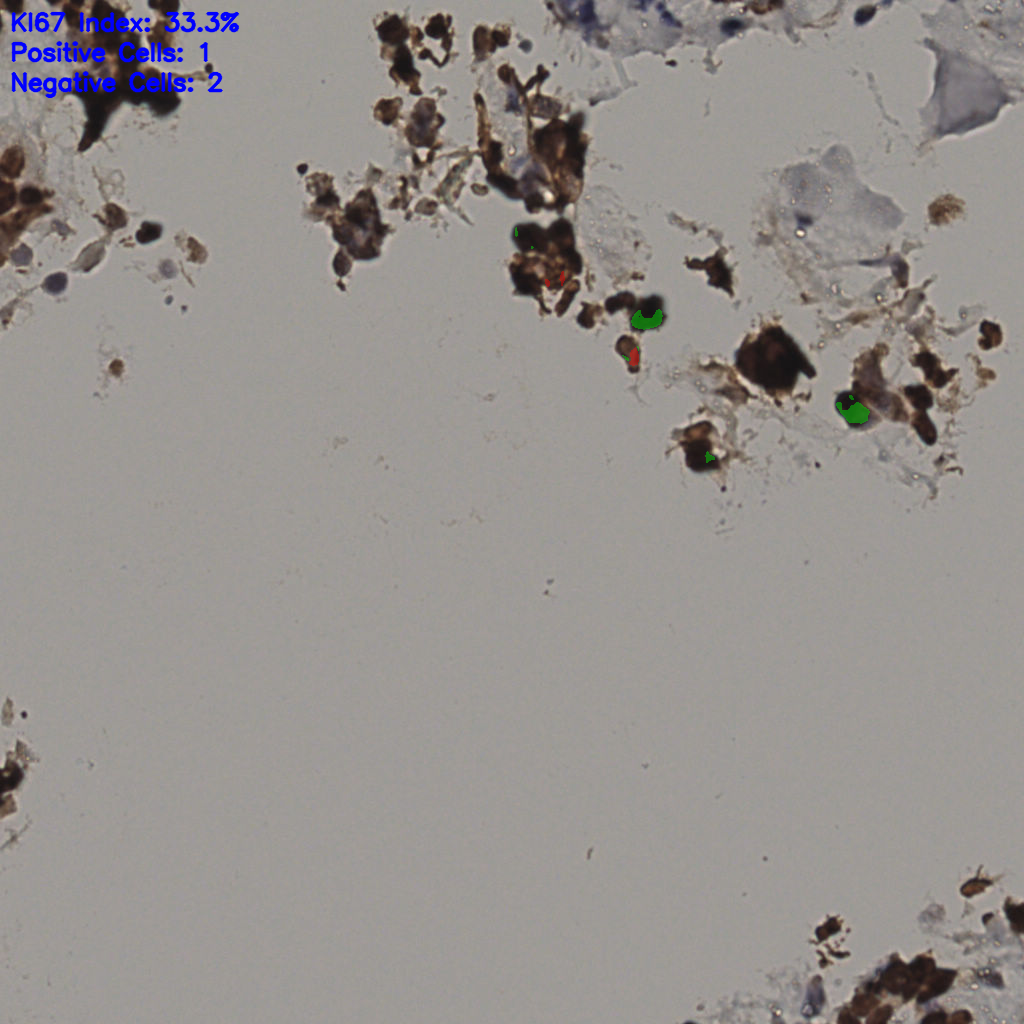 slice_34_16_x30464_y14336.png