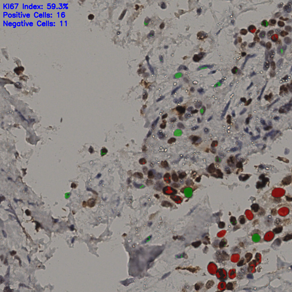 slice_34_19_x30464_y17024.png