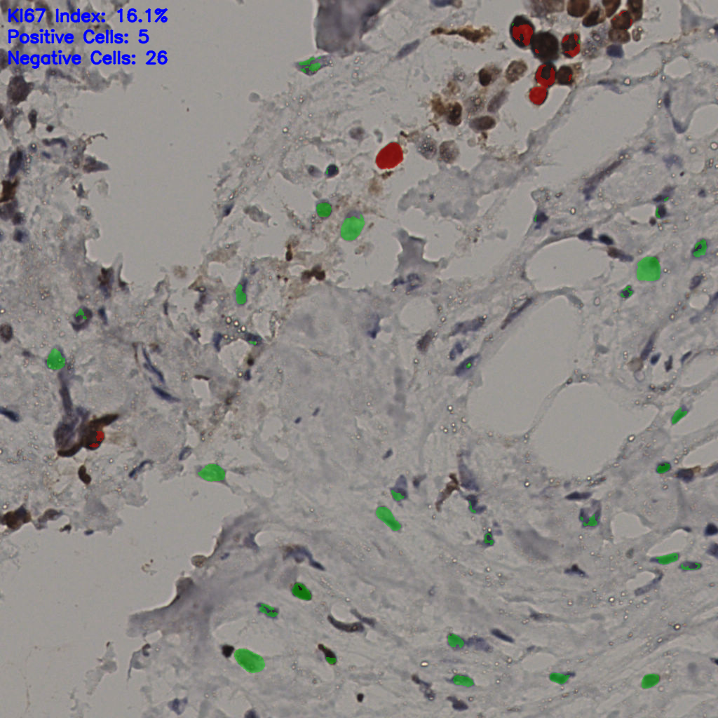 slice_34_20_x30464_y17920.png