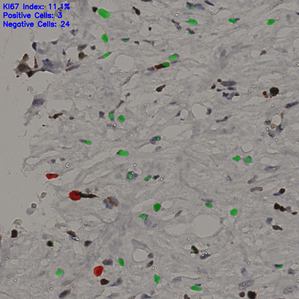 slice_34_21_x30464_y18816.png