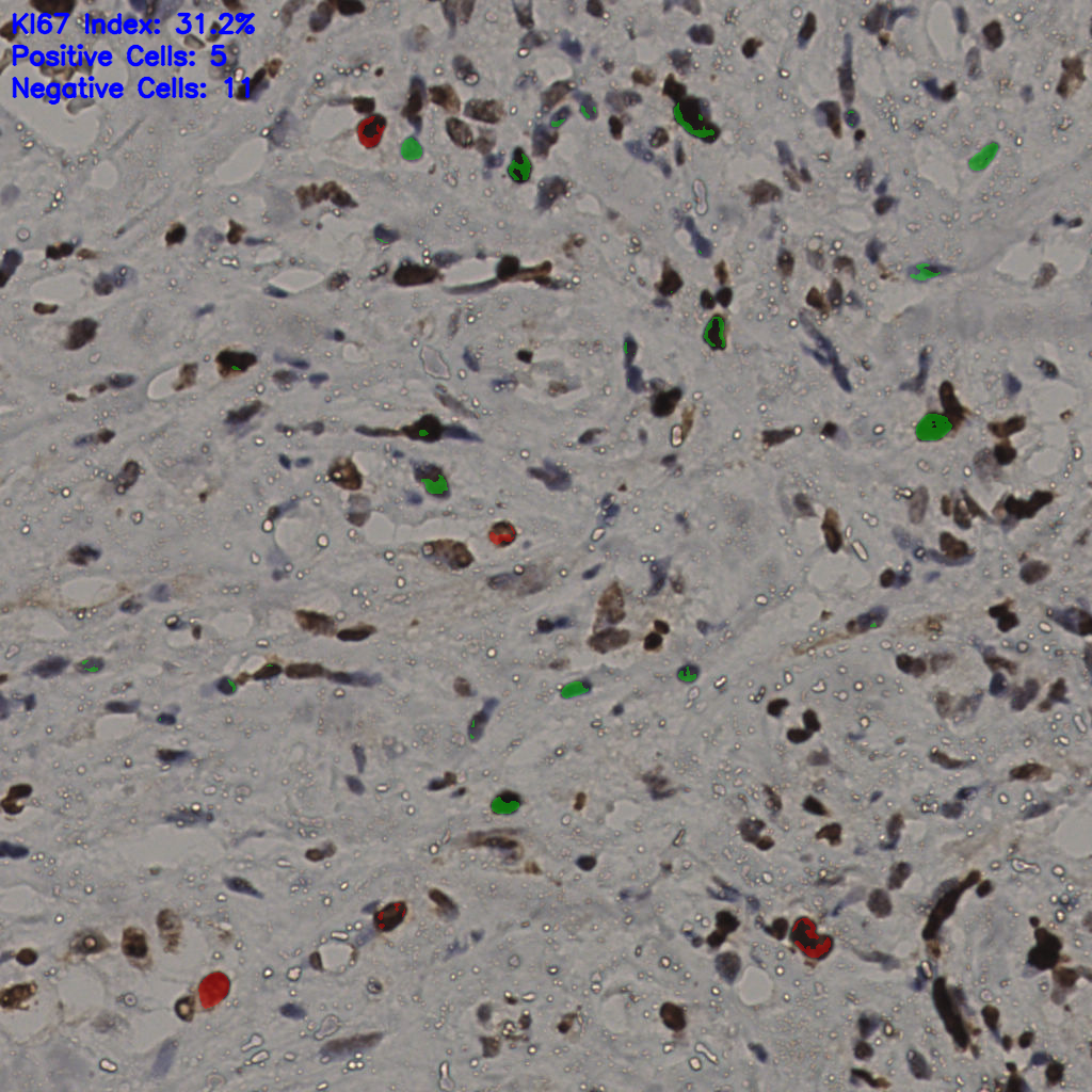 slice_34_23_x30464_y20608.png