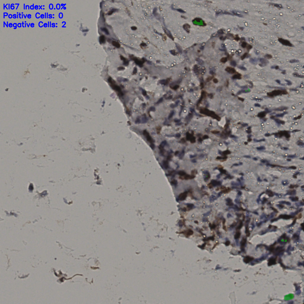 slice_35_10_x31360_y8960.png