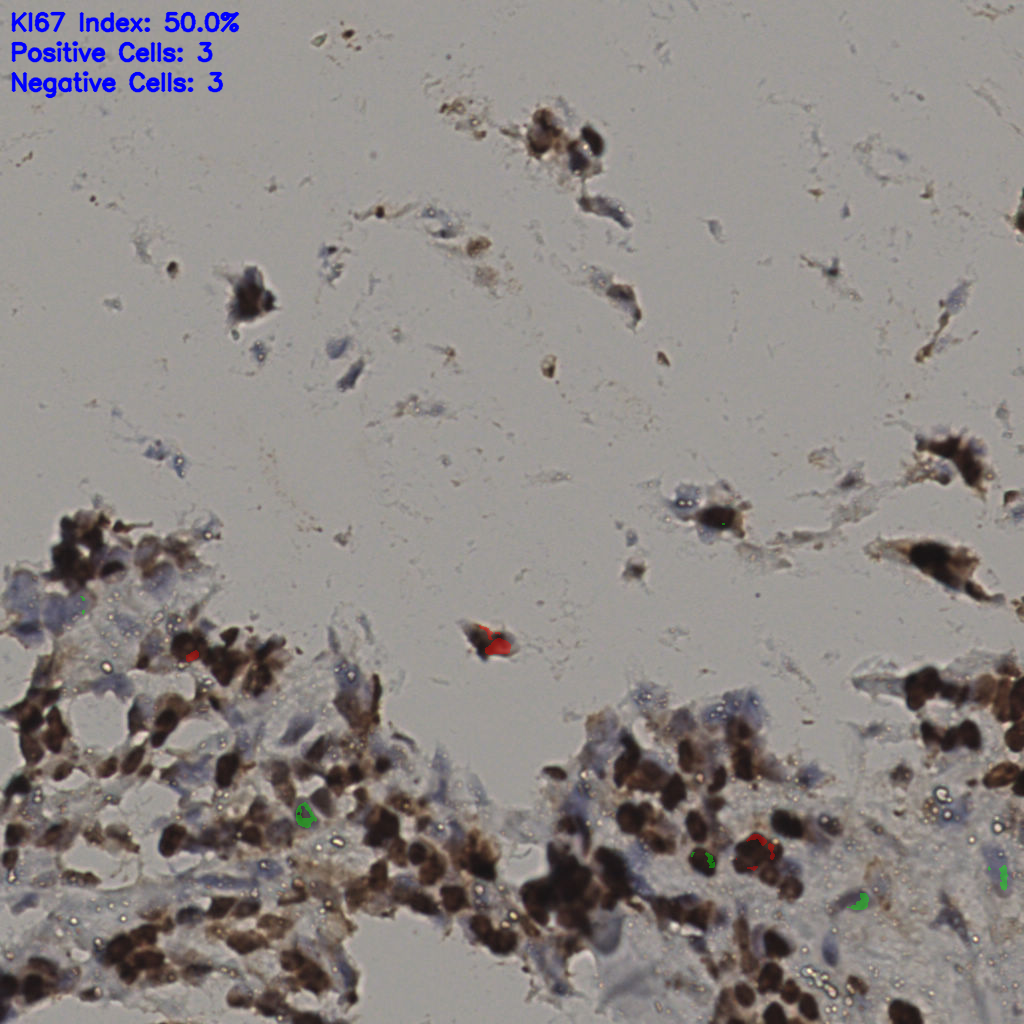 slice_35_12_x31360_y10752.png