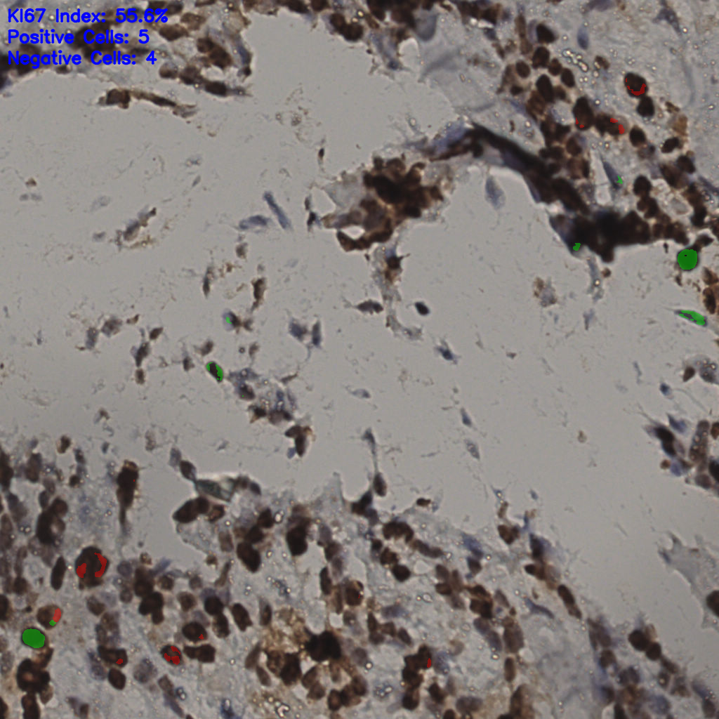 slice_35_13_x31360_y11648.png