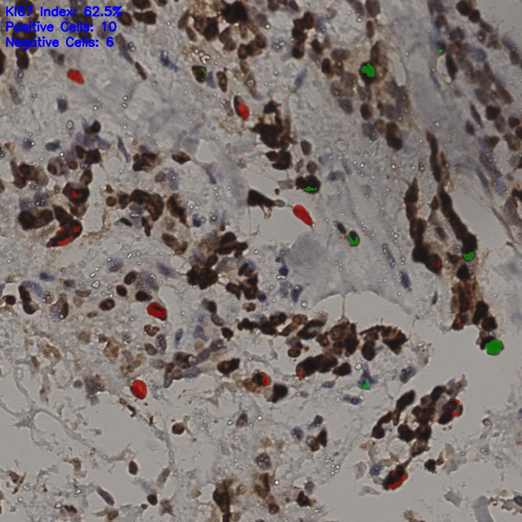 slice_35_14_x31360_y12544.png