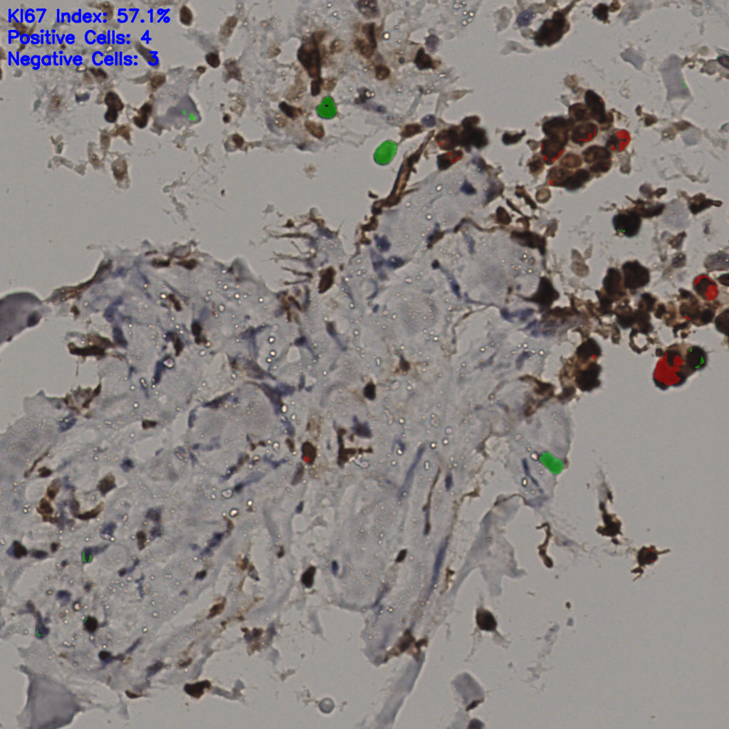 slice_35_15_x31360_y13440.png