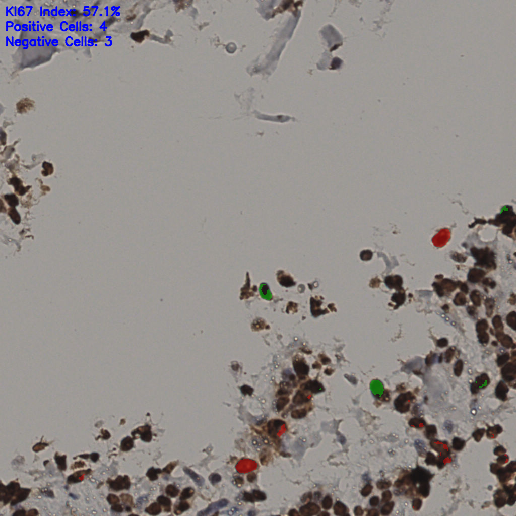 slice_35_16_x31360_y14336.png