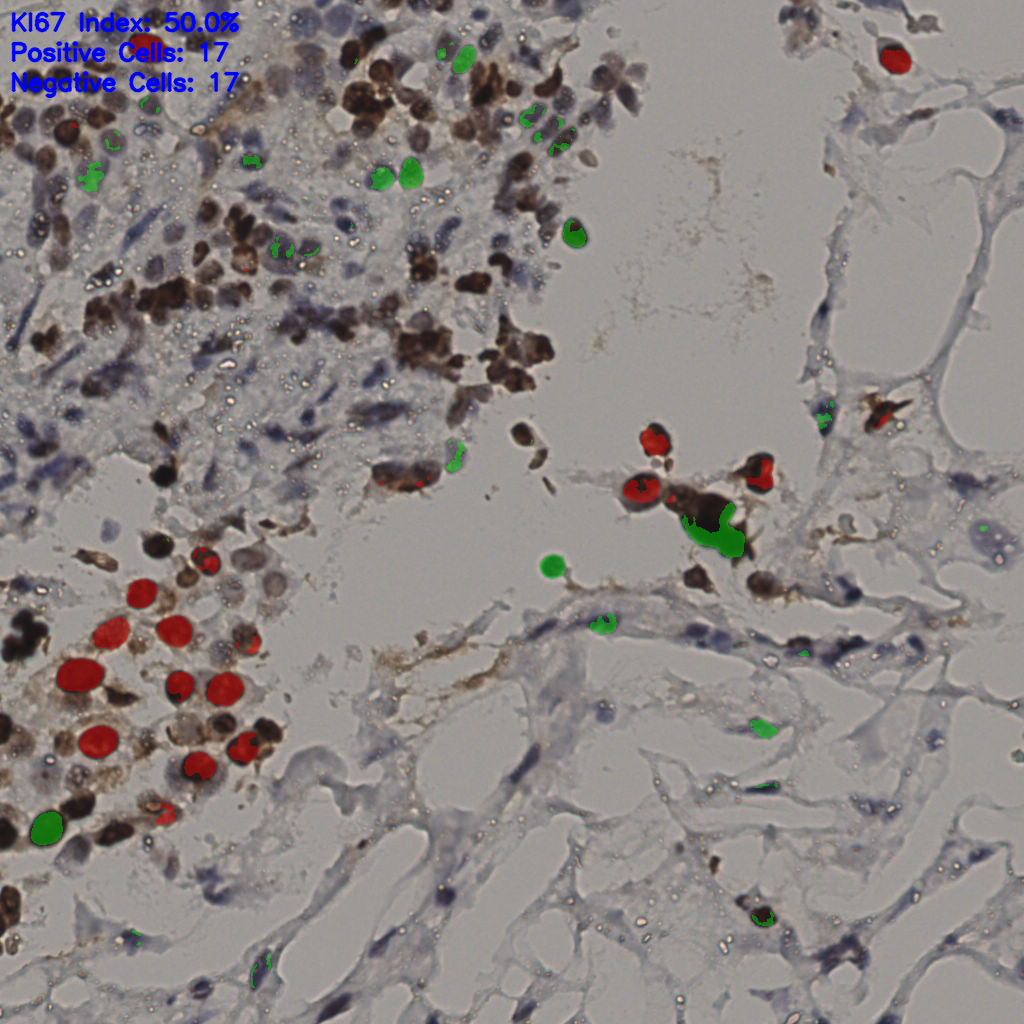 slice_35_19_x31360_y17024.png