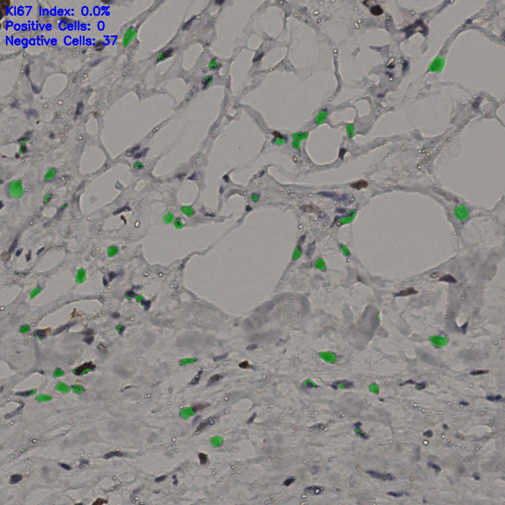 slice_35_20_x31360_y17920.png