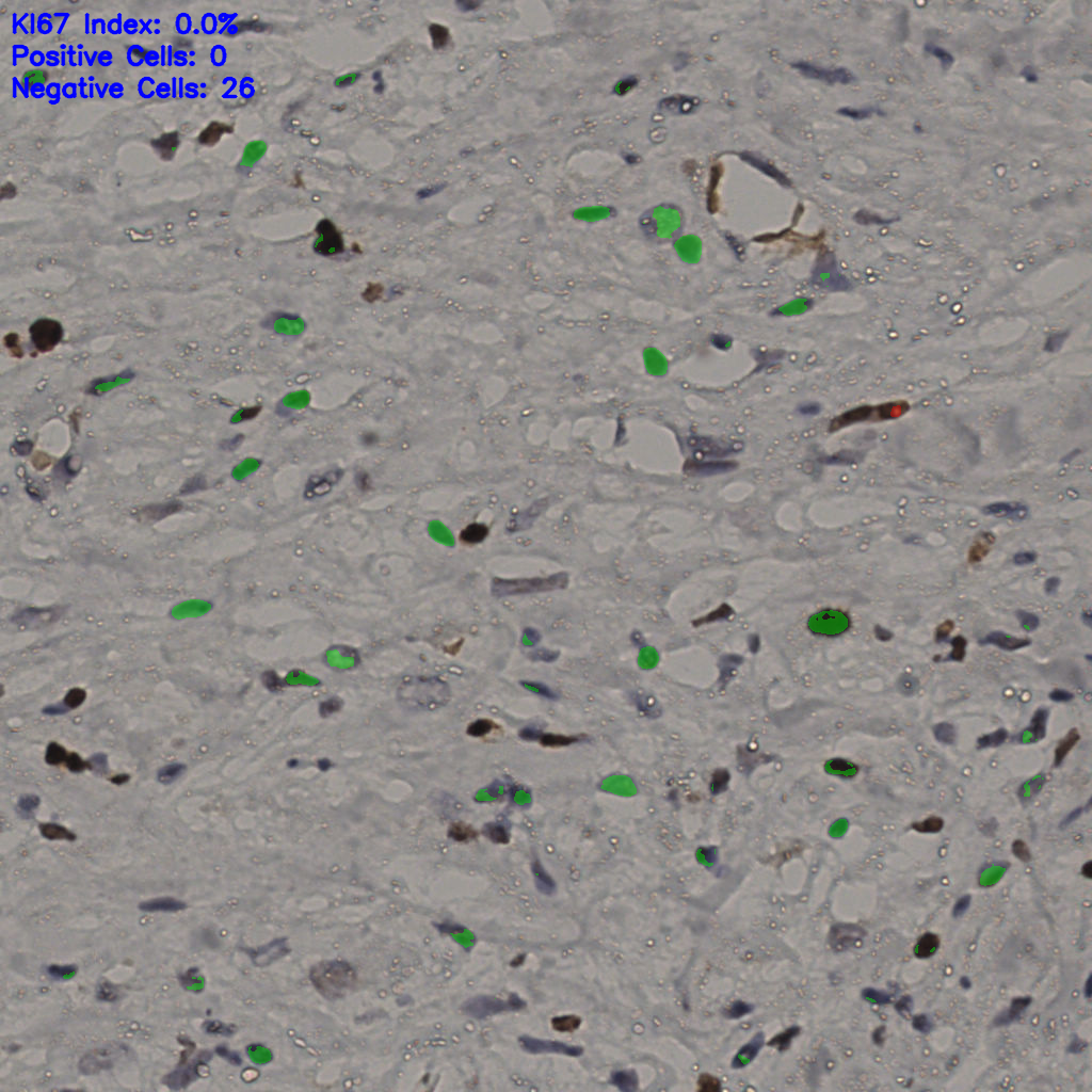 slice_35_21_x31360_y18816.png