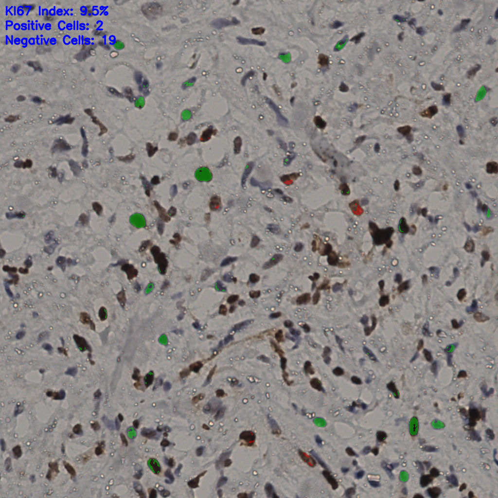 slice_35_22_x31360_y19712.png