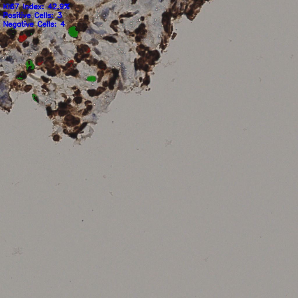 slice_35_26_x31360_y23296.png