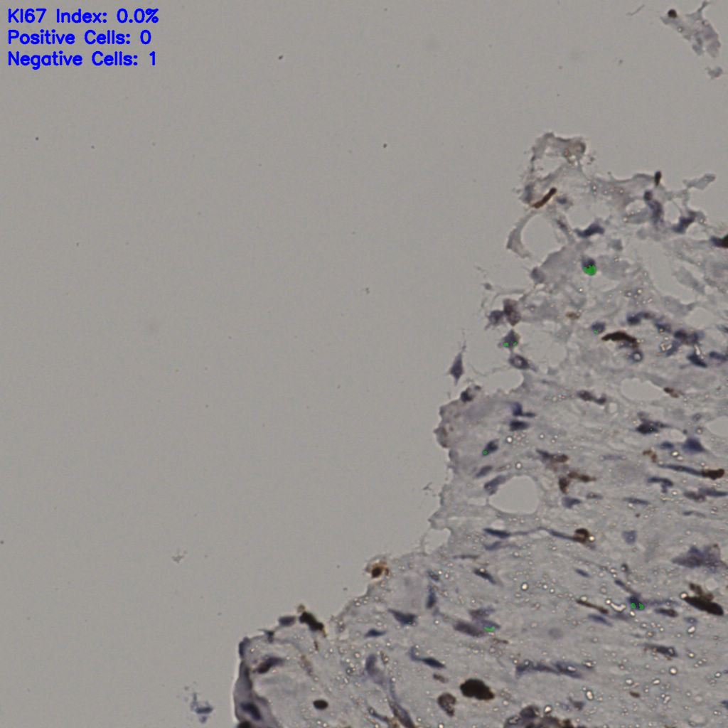 slice_35_9_x31360_y8064.png