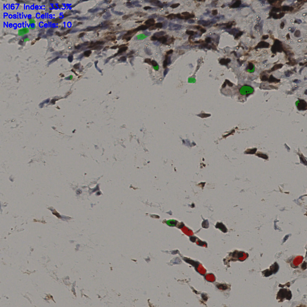 slice_36_11_x32256_y9856.png