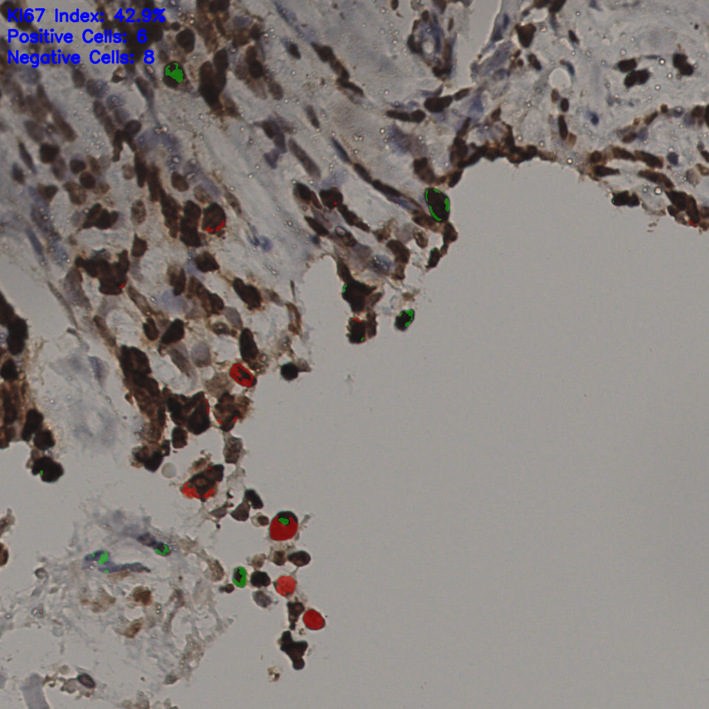 slice_36_14_x32256_y12544.png