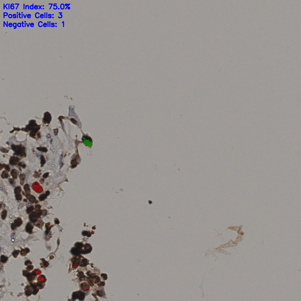 slice_36_16_x32256_y14336.png