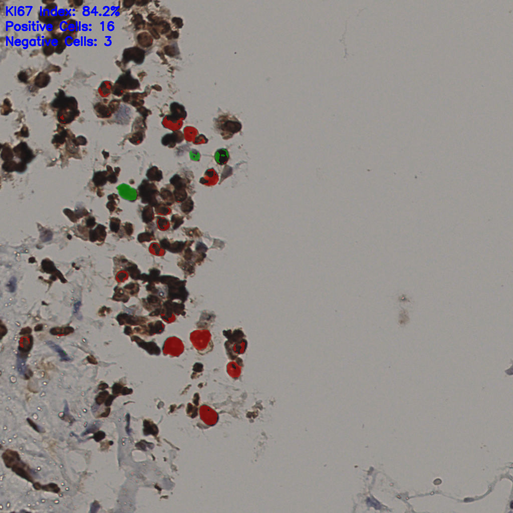slice_36_17_x32256_y15232.png
