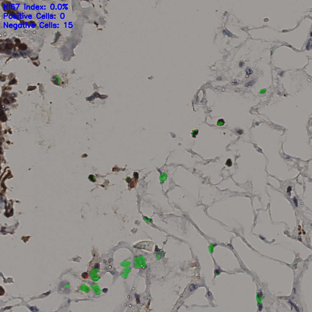 slice_36_18_x32256_y16128.png