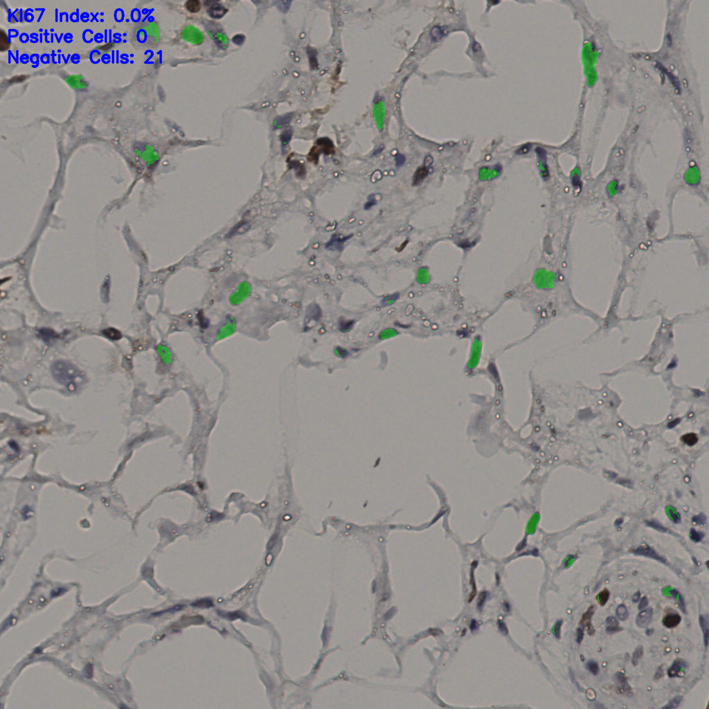 slice_36_19_x32256_y17024.png