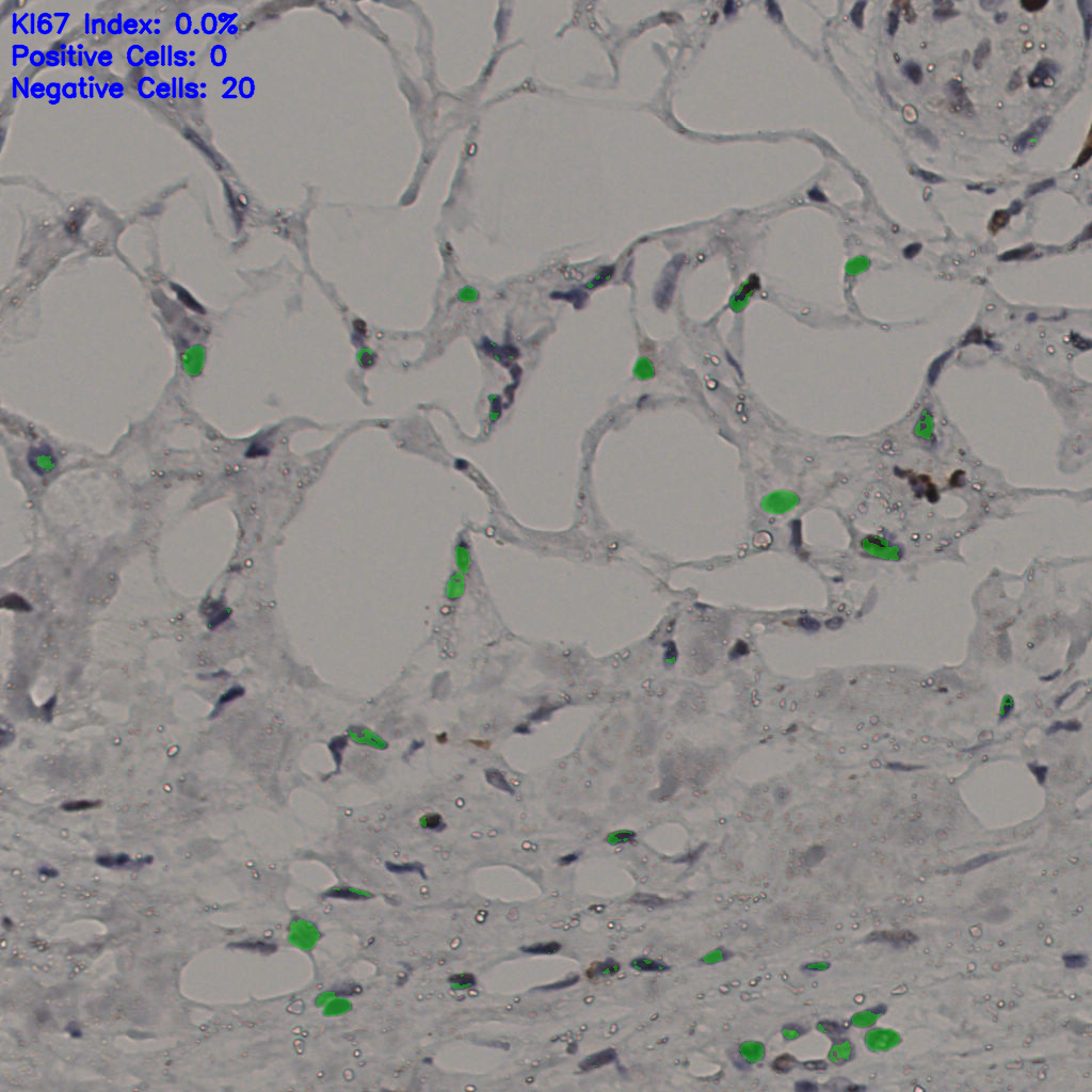slice_36_20_x32256_y17920.png