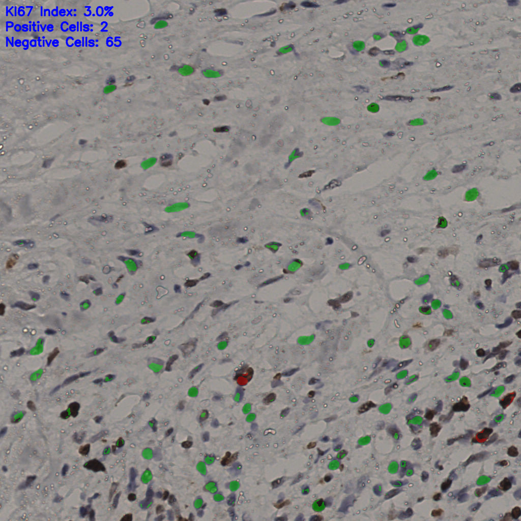 slice_36_21_x32256_y18816.png