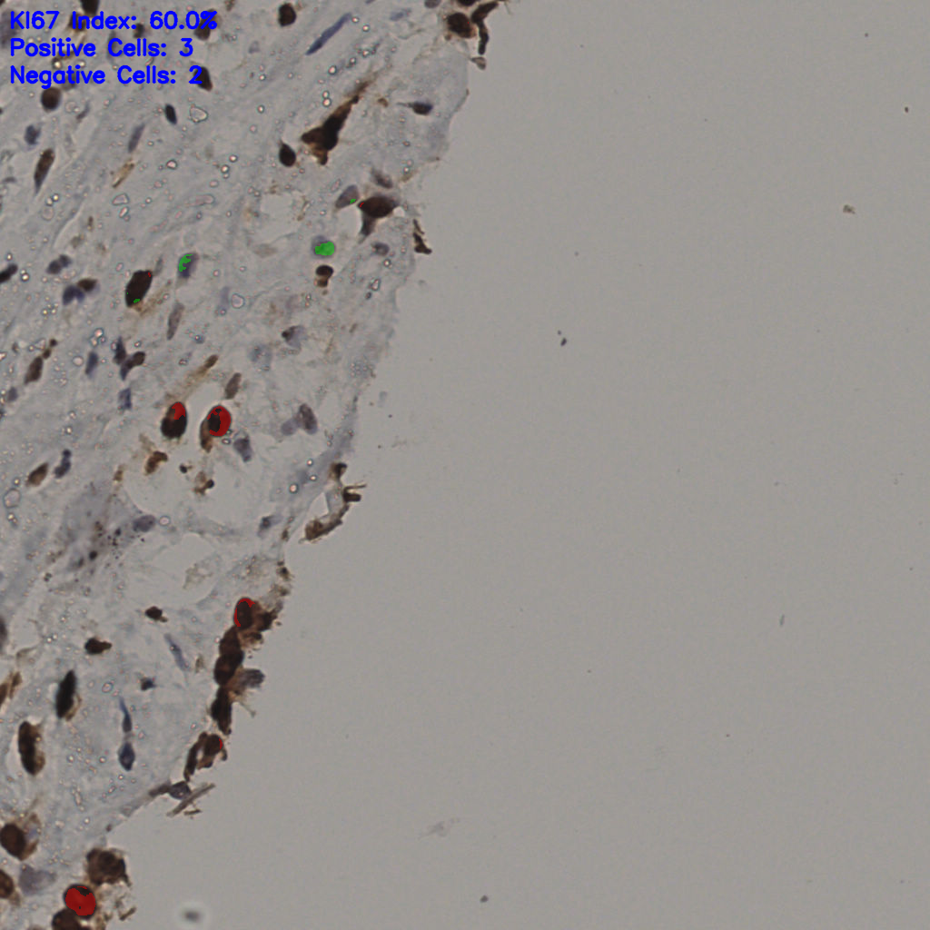 slice_36_24_x32256_y21504.png