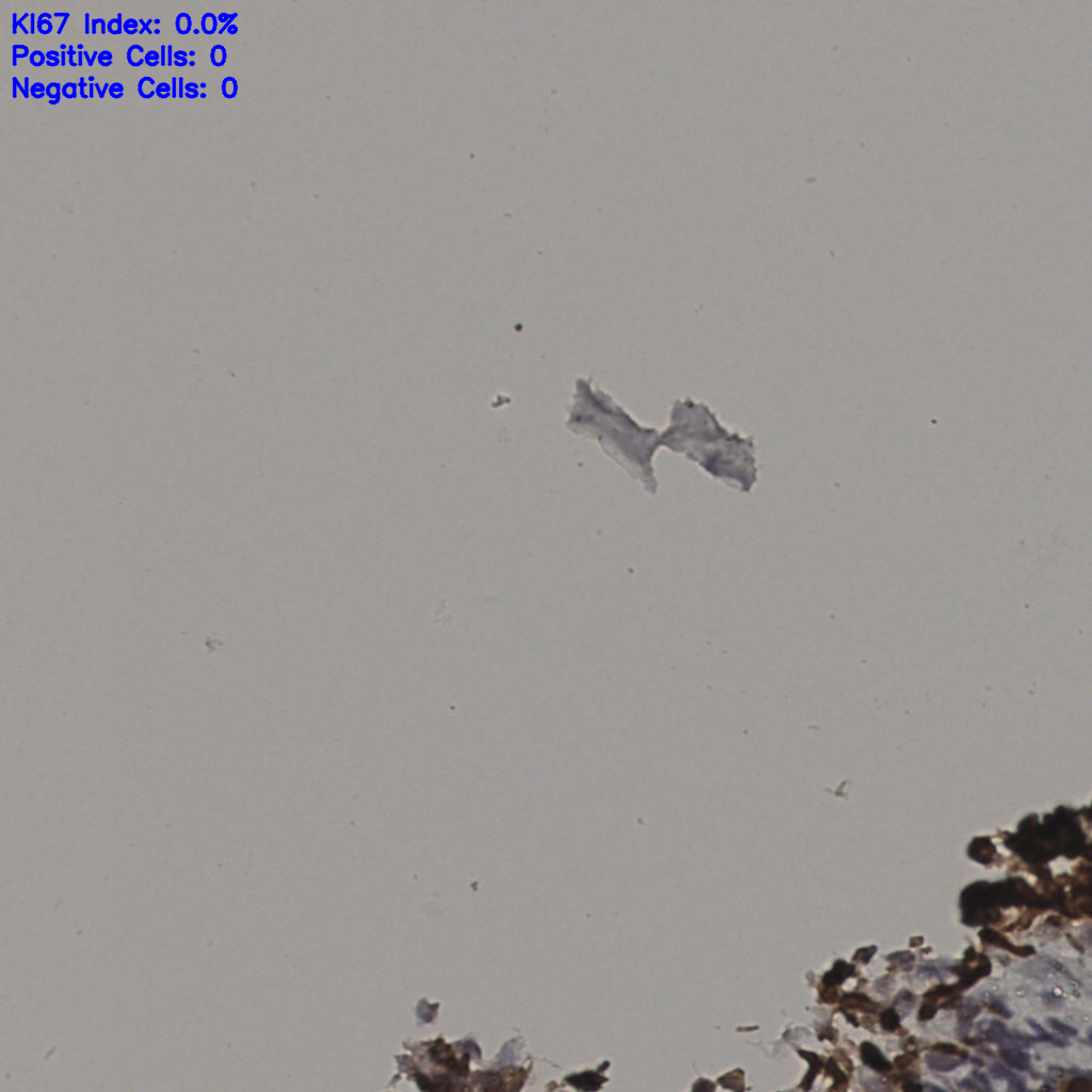 slice_36_3_x32256_y2688.png