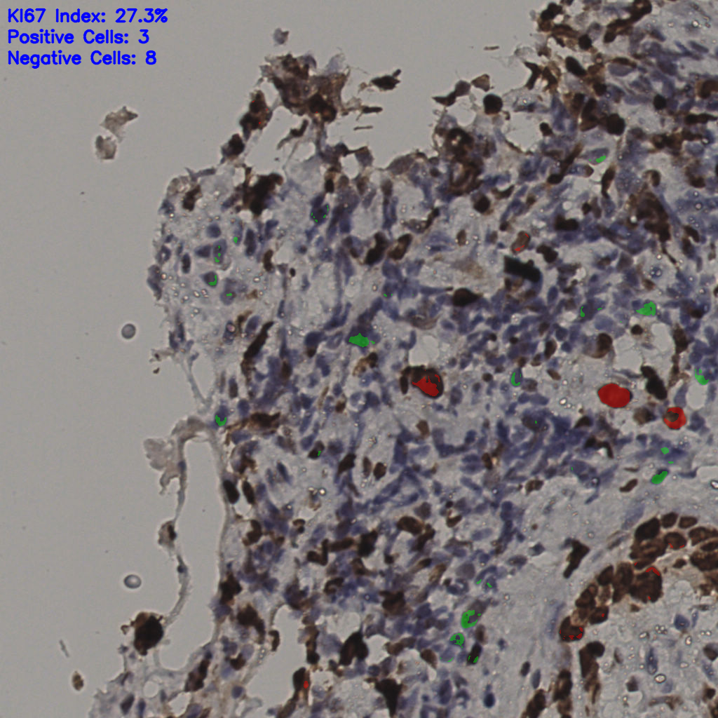 slice_36_4_x32256_y3584.png