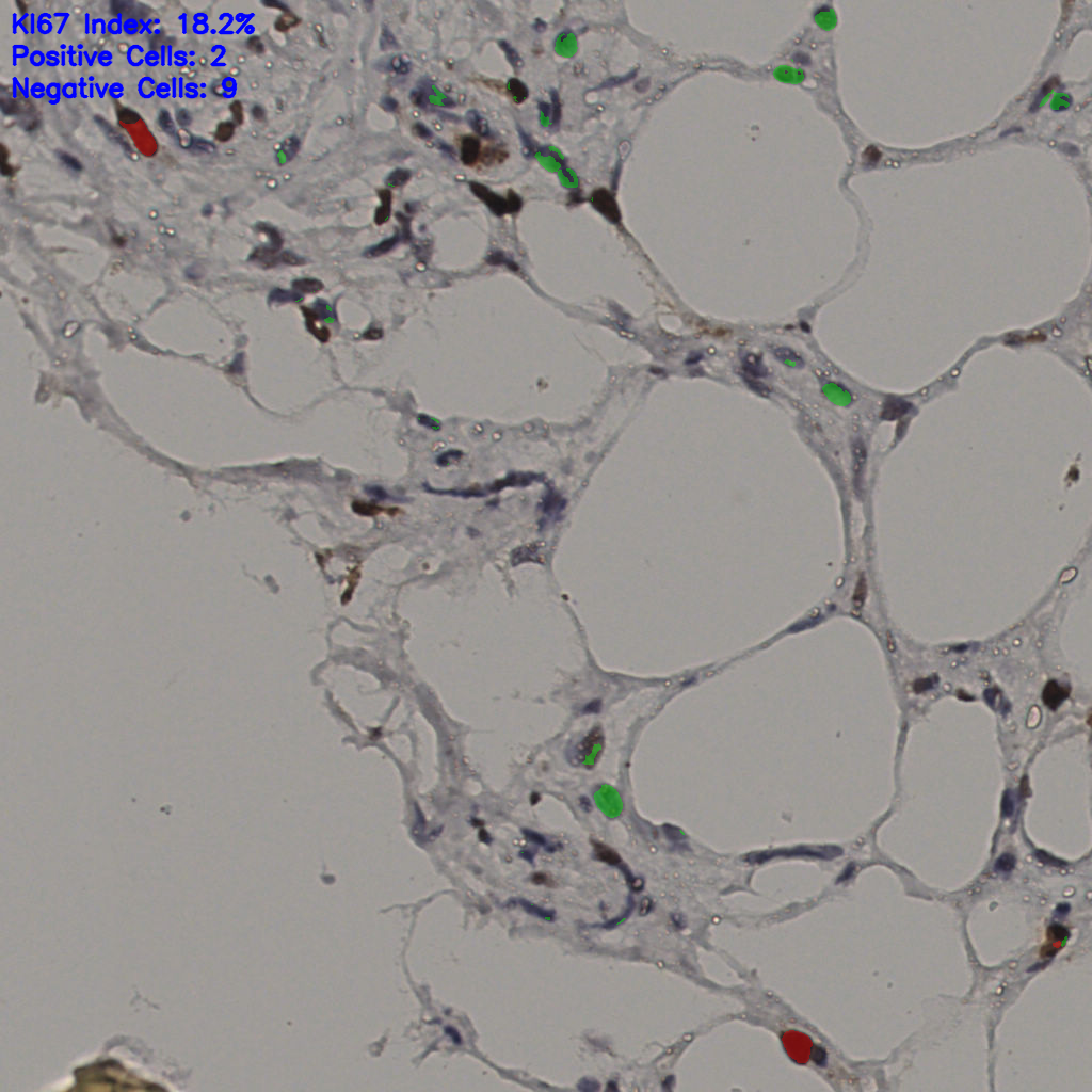 slice_36_6_x32256_y5376.png
