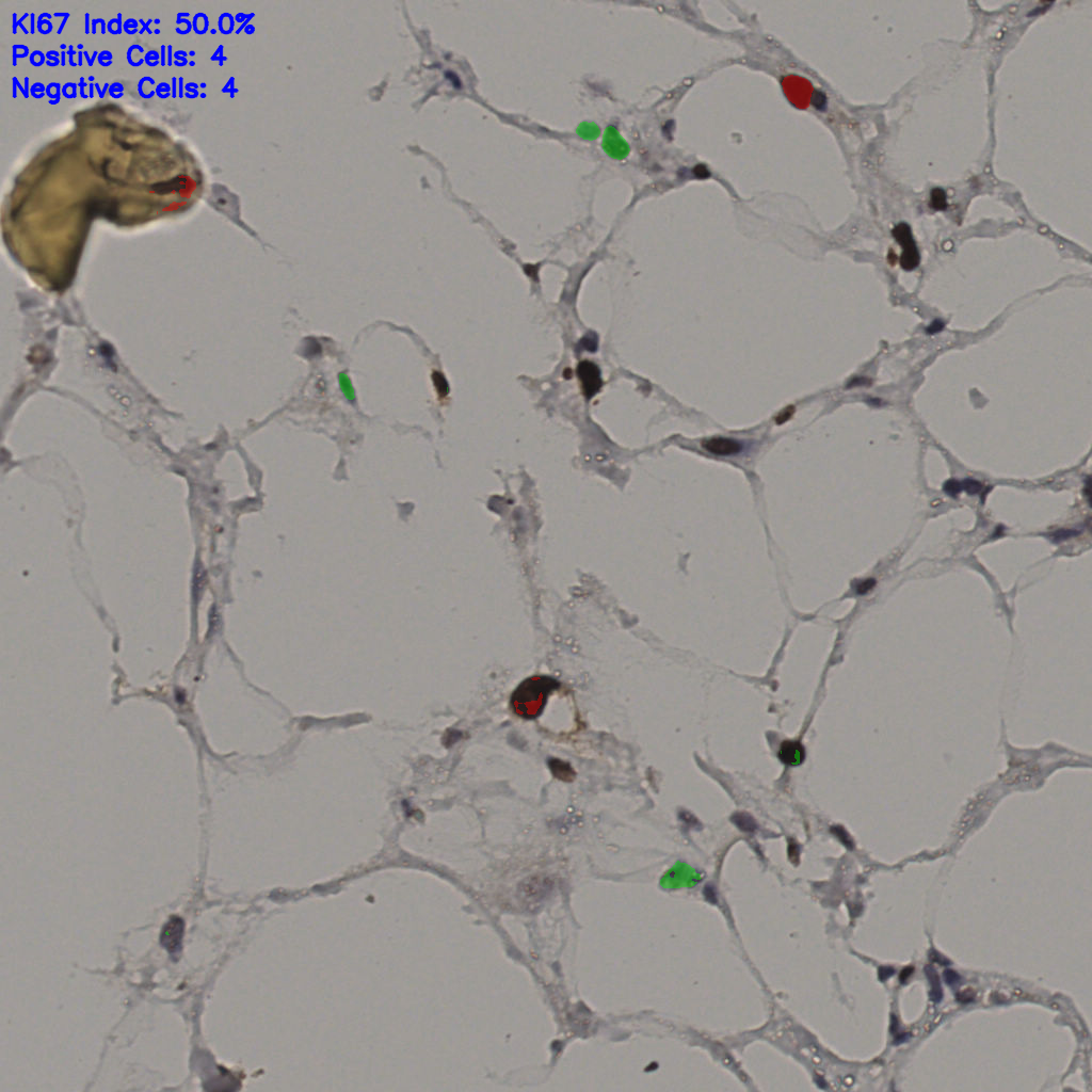 slice_36_7_x32256_y6272.png