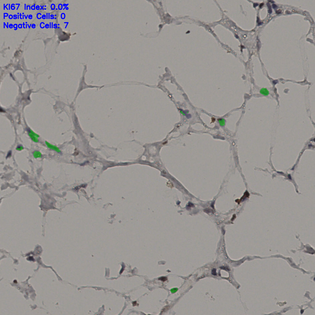 slice_36_8_x32256_y7168.png