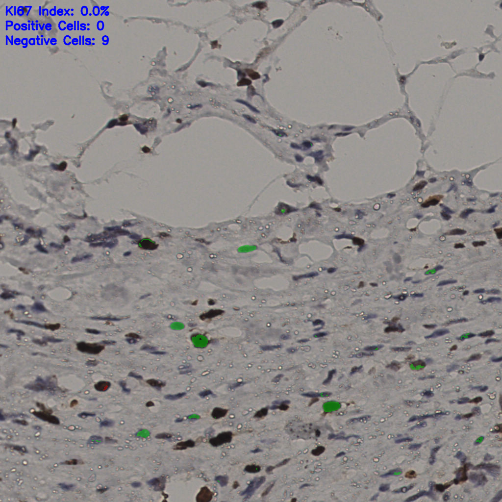 slice_36_9_x32256_y8064.png